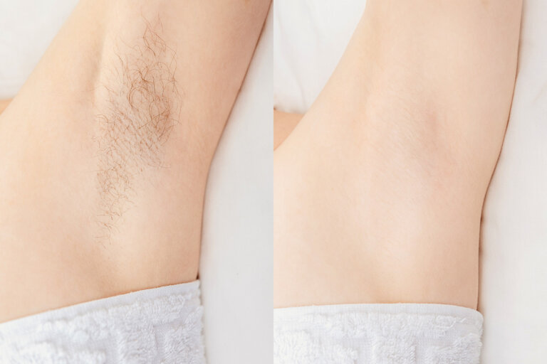 How to Wax Armpits for Smooth, Soft Skin | Waxing the City